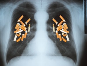 Effects of cigarette smoking - lung cancer